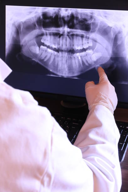 Best Emergency Dental Extractions in Fair Oaks, GA
