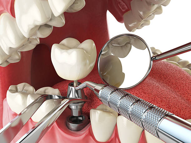Best Emergency Cosmetic Dentistry in Fair Oaks, GA